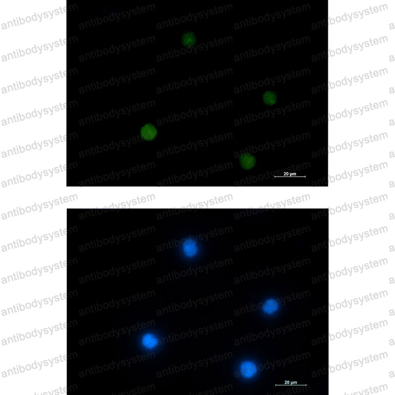 Anti-ACTL6A Antibody (R1H01)