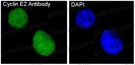 Anti-CCNE2 Antibody (R1H02)
