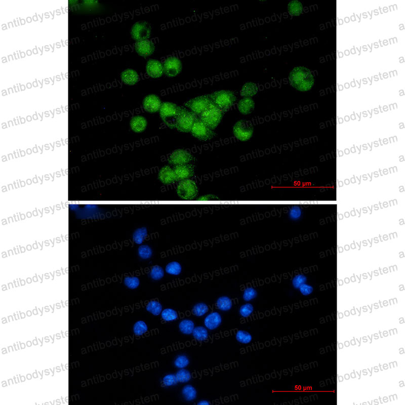Anti-CCNE2 Antibody (R1H03)