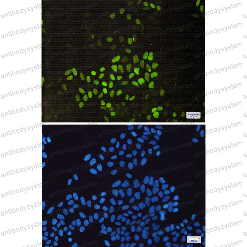 Anti-CCNE2 Antibody (R1H04)