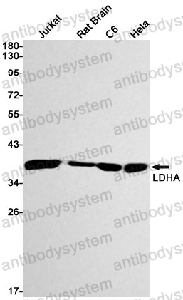 Anti-LDHA Antibody (R1H06)