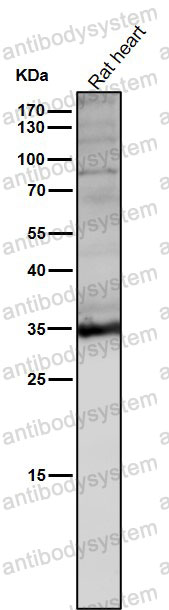 Anti-LDHA Antibody (R1H05)
