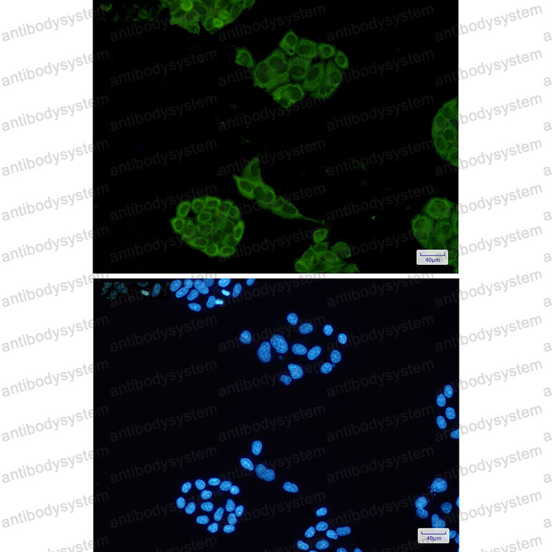Anti-LDHA Antibody (R1H07)
