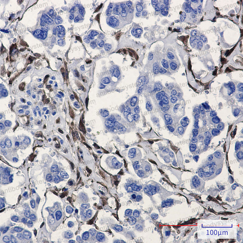 Anti-ALDH1A1 Antibody (R1H08)