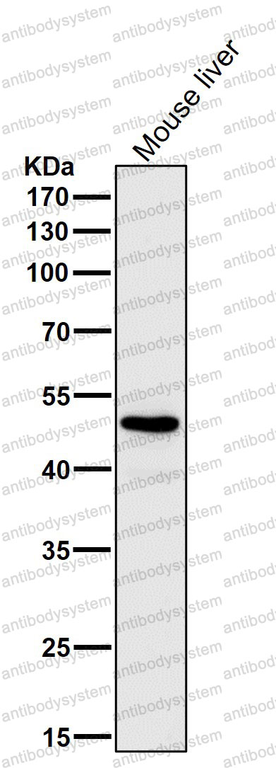 Anti-GLUD1 Antibody (R1H09)