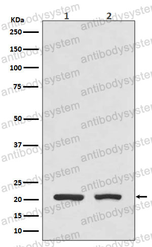 Anti-DHFR Antibody (R1H10)
