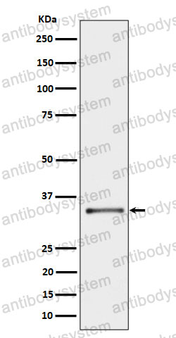 Anti-CYB5R3 Antibody (R1H11)
