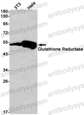 Anti-GSR Antibody (R1H14)