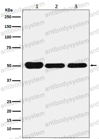 Anti-GSR Antibody (R1H13)