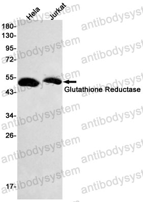 Anti-GSR Antibody (R1H15)