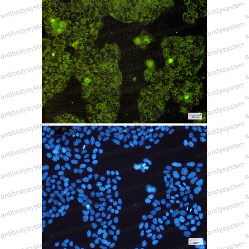 Anti-MT-CO2 Antibody (R1H17)