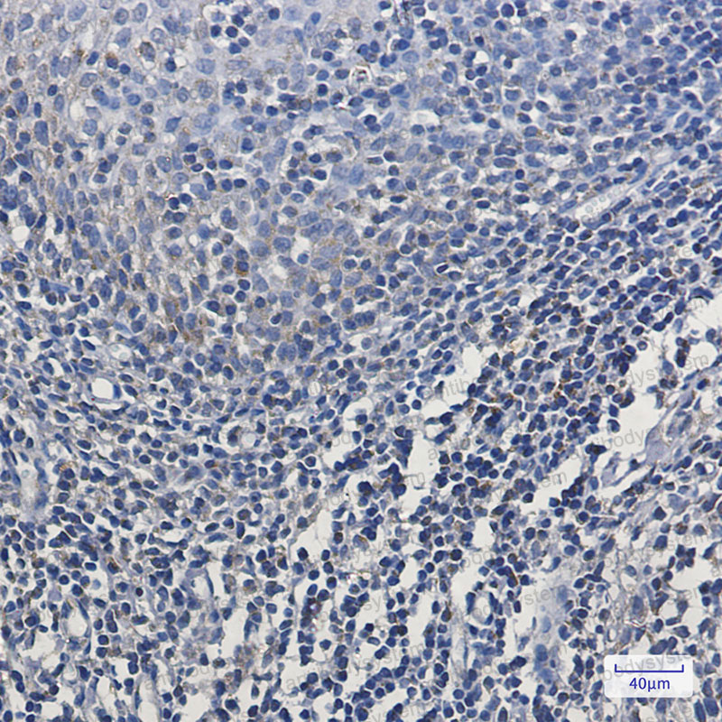 Anti-MT-CO2 Antibody (R1H18)