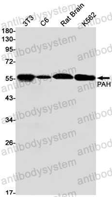 Anti-PAH Antibody (R1H20)