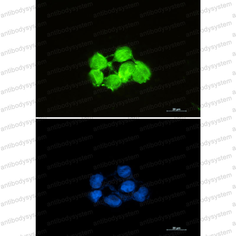 Anti-SOD1 Antibody (R1H22)