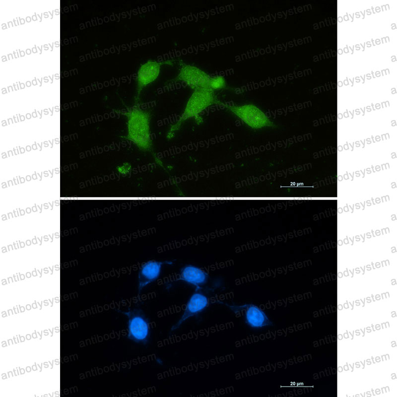 Anti-SOD1 Antibody (R1H23)