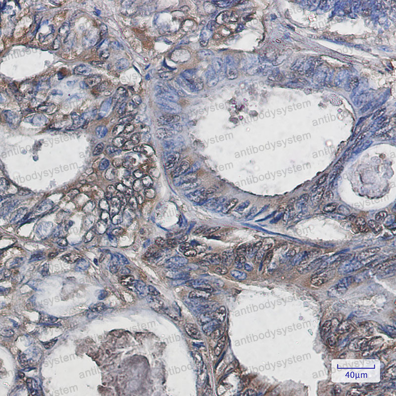 Anti-SOD1 Antibody (R1H21)