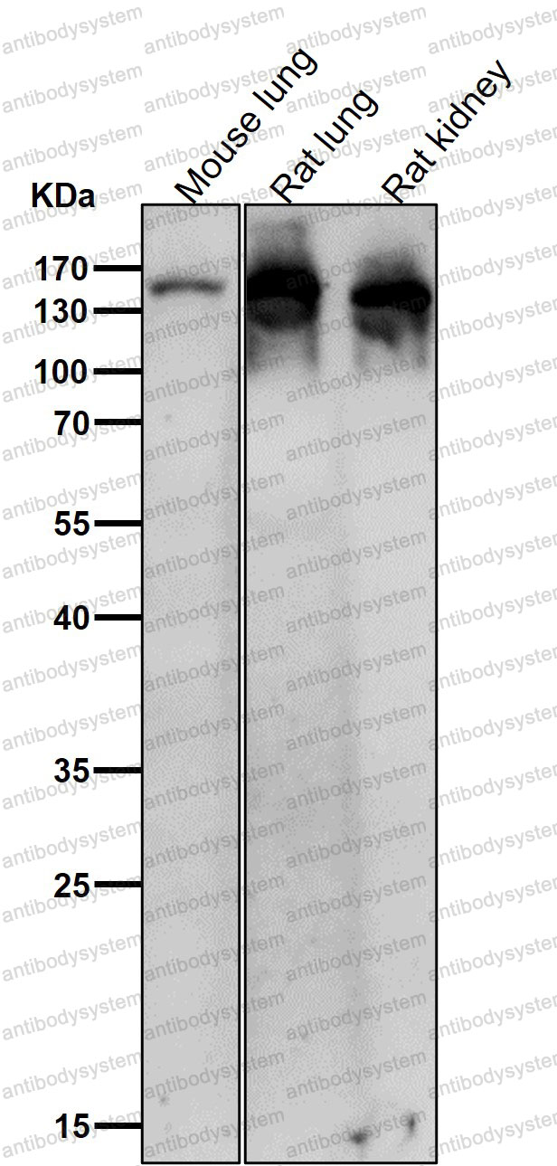 Anti-CP Antibody (R1B79)