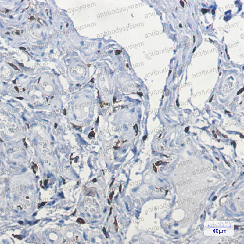 Anti-F13A1 Antibody (R1H25)