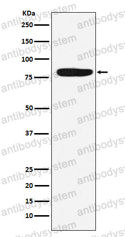 Anti-F13A1 Antibody (R1H24)