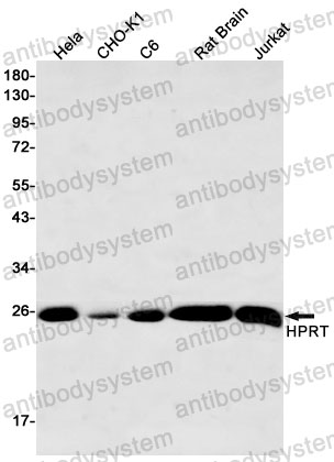Anti-HPRT1 Antibody (R1H26)