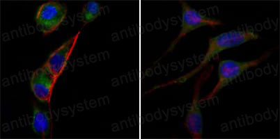 Immunofluorescence for Anti-GOT2 Antibody (R2W73) ?>