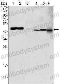 Western blot for Anti-GOT2 Antibody (R2W73) ?>