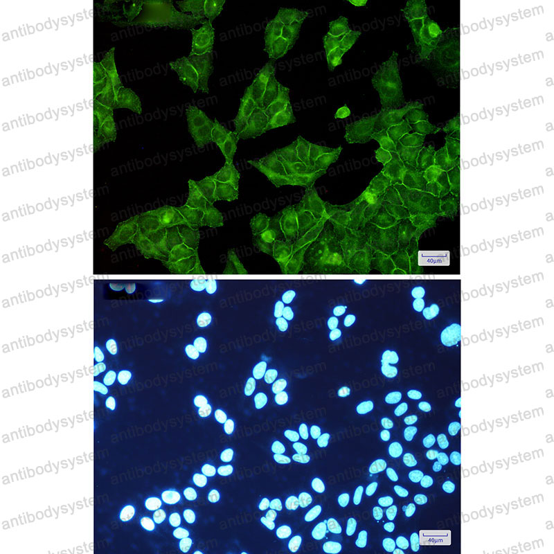Anti-EGFR/ERBB1/HER1 Antibody (R1H33)