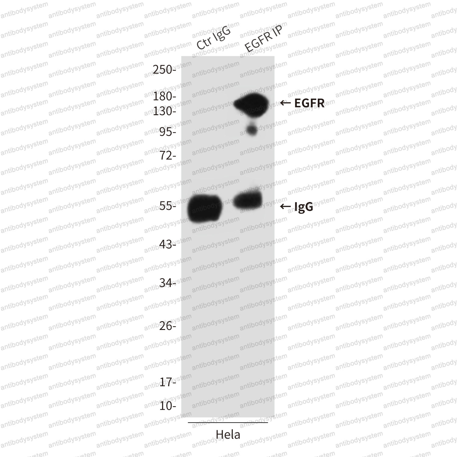 Anti-EGFR/ERBB1/HER1 Antibody (R2W79)