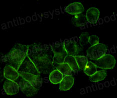 Anti-EGFR/ERBB1/HER1 Antibody (R2W81)