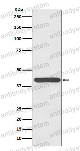 Anti-HP Antibody (R1H37)