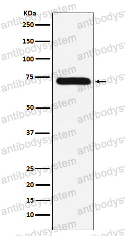 Anti-F10/Factor X Antibody (R1H39)
