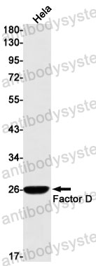 Anti-CFD Antibody (R1H41)