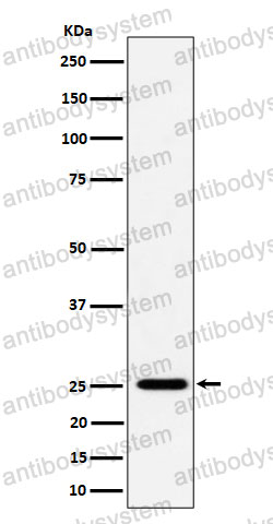 Anti-CFD Antibody (R1H40)