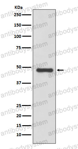 Anti-PLAU/Urokinase Antibody (R1H42)