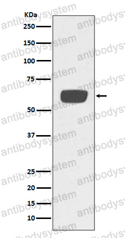 Anti-PLAT/tPA Antibody (R1H43)