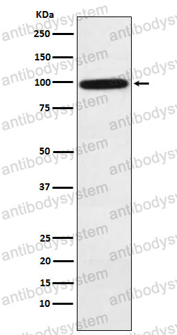 Anti-CFB/Complement factor B Antibody (R1H44)