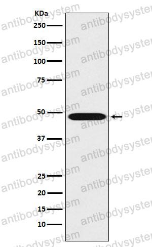 Anti-REN/Renin Antibody (R1H45)