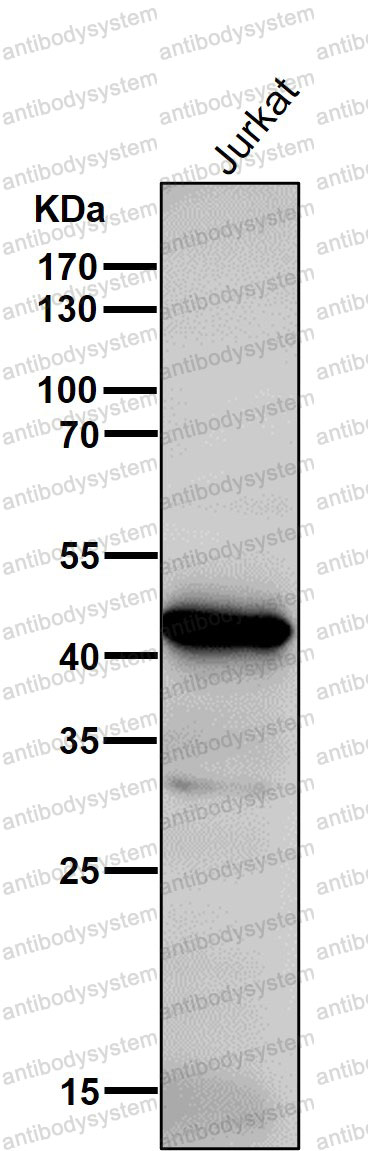Anti-ADA/Adenosine deaminase Antibody (R1H46)