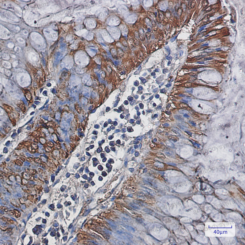 Anti-CA1/Carbonic anhydrase 1 Antibody (R1H47)