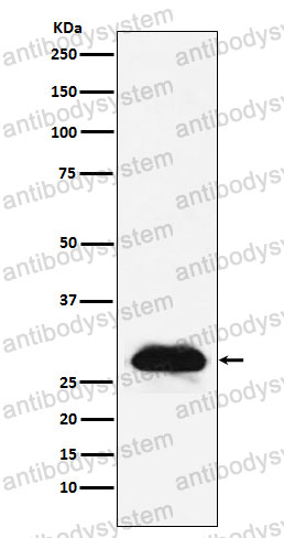 Anti-CA2/Carbonic anhydrase 2 Antibody (R1H48)