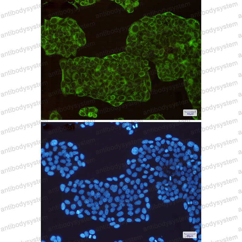Anti-ASS1 Antibody (R1H49)