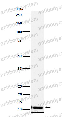 Anti-SPINK1 Antibody (R1H50)