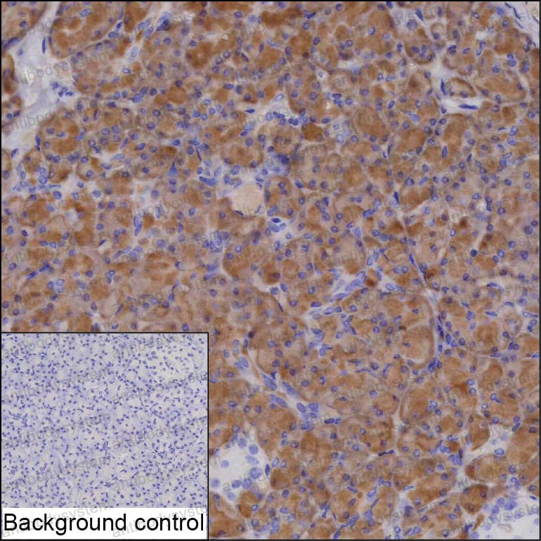 Immunohistochemical for Anti-SPINK1 Antibody (R2W90) ?>