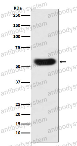 Anti-SERPINC1 Antibody (R1H51)