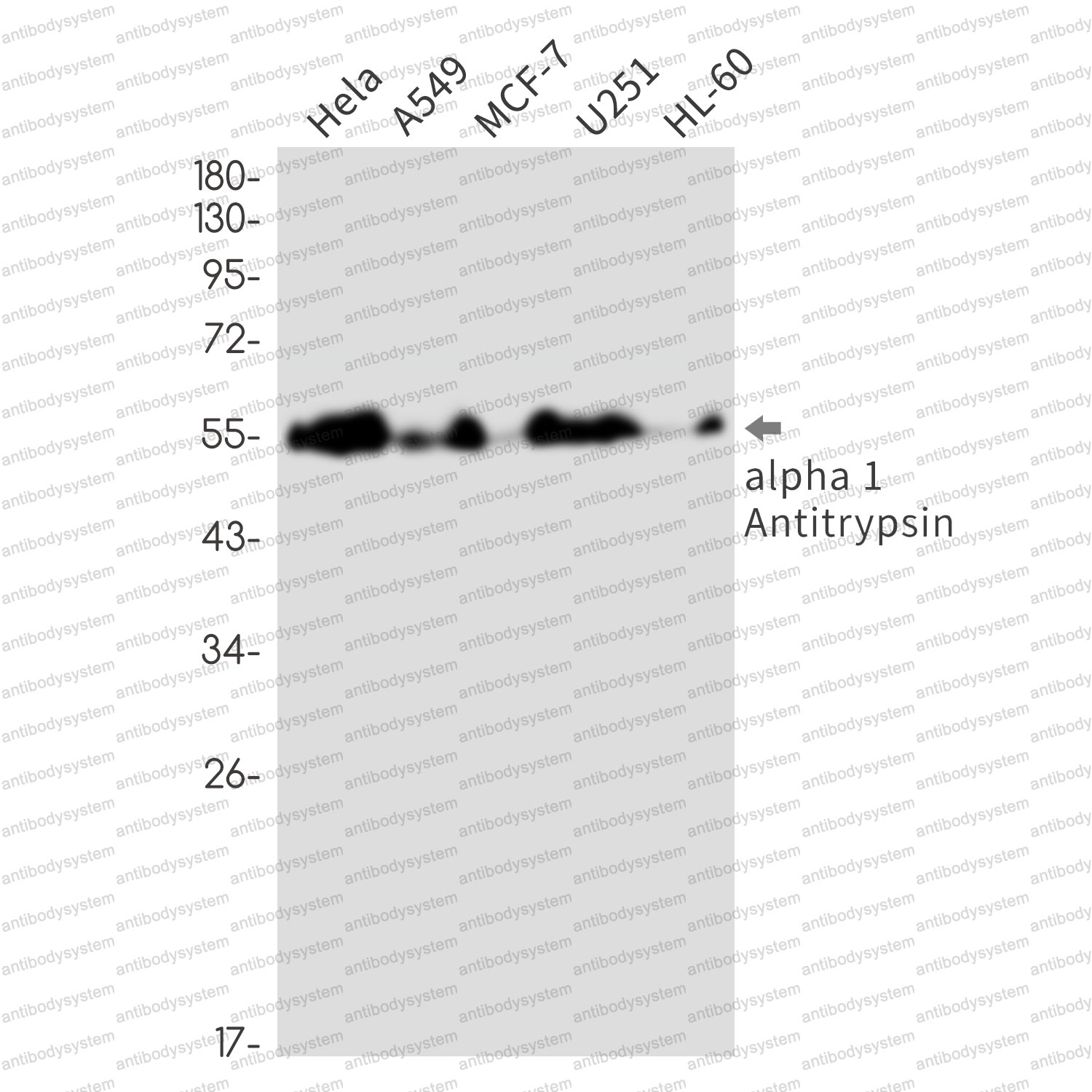 Anti-a1AT/Serpin A1/SERPINA1 Antibody (R1H52)