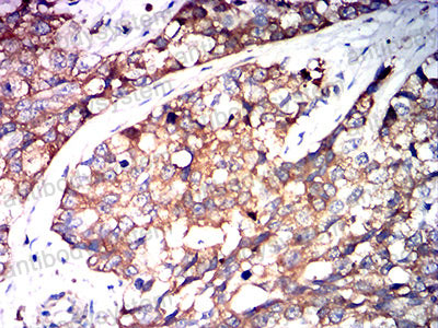 Immunohistochemical for Anti-a1AT/Serpin A1/SERPINA1 Antibody (R2W95) ?>
