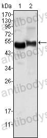Western blot for Anti-a1AT/Serpin A1/SERPINA1 Antibody (R2W93) ?>