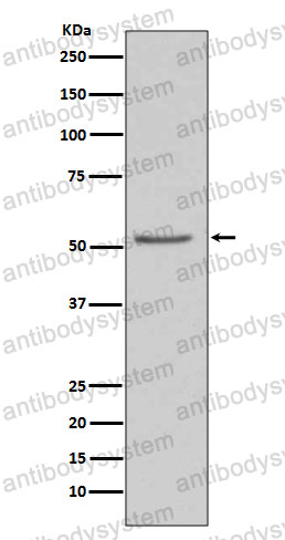 Anti-AGT Antibody (R1H53)