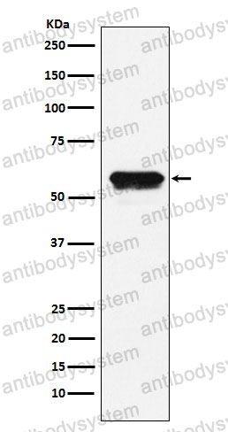 Anti-AGT Antibody (R1H54)