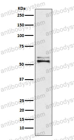 Anti-AGT Antibody (R1H55)